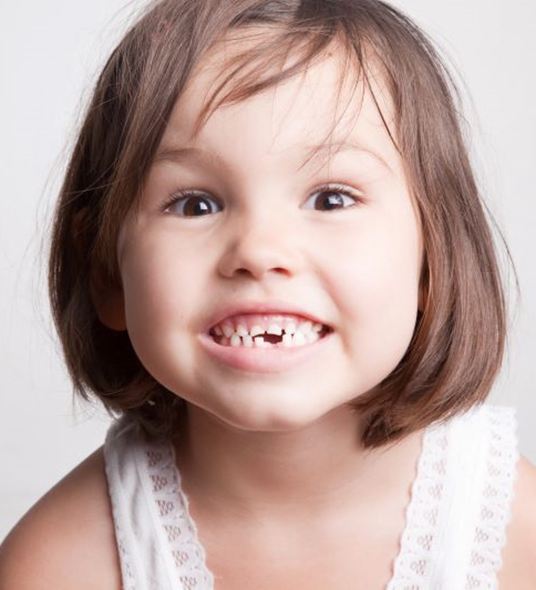 Smiling little girl with missing tooth